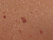 Mole Image 1B - small