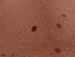 Mole Image 1D - small